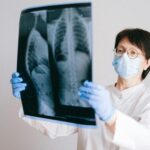 Doctor in protective gear examining chest x-ray for diagnosis.